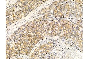 anti-Rhomboid 5 Homolog 1 (RHBDF1) antibody
