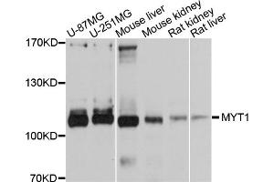 Western blot analysis of extracts of various cell lines, using MYT1 antibody (ABIN5998292) at 1/1000 dilution. (MYT1 anticorps)
