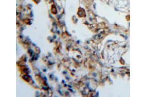Used in DAB staining on fromalin fixed paraffin-embedded lung tissue