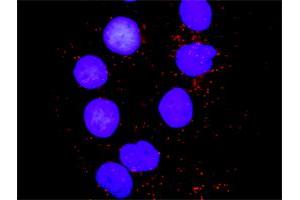 Proximity Ligation Analysis of protein-protein interactions between PXN and MAPK8.