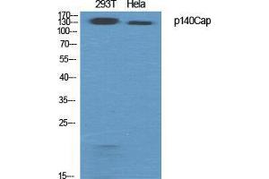 Western Blot (WB) analysis of specific cells using p140Cap Polyclonal Antibody.