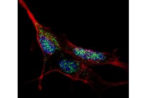 Fluorescent confocal image of SY5Y cells stained with (ABIN389189 and ABIN2839352) KLF4 antibody.