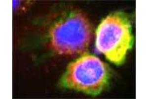 Confocal microscopy on isolated monocytes. (Myeloperoxidase anticorps)