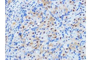 Immunohistochemistry of paraffin-embedded rat ovary using PP1 beta Rabbit mAb (ABIN1679819, ABIN3018859, ABIN3018860 and ABIN7101675) at dilution of 1:100 (40x lens). (PPP1CB anticorps)