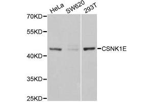 Western Blotting (WB) image for anti-Casein Kinase 1, epsilon (CSNK1E) antibody (ABIN1980191) (CK1 epsilon anticorps)