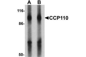 Western blot analysis of CCP110 in human colon tissue lysate with CCP110 Antibody  at (A) 1 and (B) 2 ug/mL. (Centriolin anticorps  (C-Term))