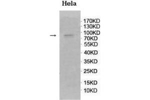 Western blot analysis of fetal brain lysate using GnT-V Antibody at a dilution of 1/500.
