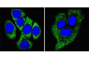 Confocal immunofluorescence analysis of methanol-fixed ECA109 cells (left) and HepG2 cells (right) using CK8 mouse mAb (green), showing cytoplasmic localization.