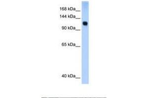 Image no. 1 for anti-SWI/SNF Related, Matrix Associated, Actin Dependent Regulator of Chromatin, Subfamily A, Member 5 (SMARCA5) (AA 51-100) antibody (ABIN6737635)