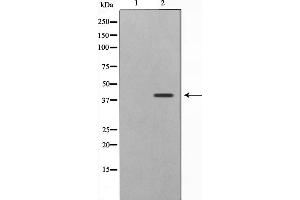 Western blot analysis on 293 cell lysate using CBX6 Antibody,The lane on the left is treated with the antigen-specific peptide. (CBX6 anticorps  (N-Term))