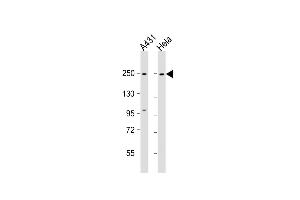 All lanes : Anti-MYH9 Antibody (N-term ) at 1:1000 dilution Lane 1: A431 whole cell lysate Lane 2: Hela whole cell lysate Lysates/proteins at 20 μg per lane. (Myosin 9 anticorps  (N-Term))