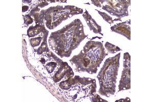 IHC analysis of MVP using anti-MVP antibody .