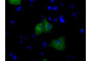 Anti-BTK mouse monoclonal antibody (ABIN2452830) immunofluorescent staining of COS7 cells transiently transfected by pCMV6-ENTRY BTK (RC211582). (BTK anticorps)