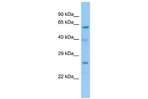 WB Suggested Anti-2700060E02Rik Antibody   Titration: 1. (RIKEN CDNA 2700060E02 Gene (2700060E02RIK) (C-Term) anticorps)