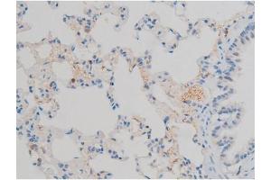 ABIN6267390 at 1/200 staining Rat lung tissue sections by IHC-P.