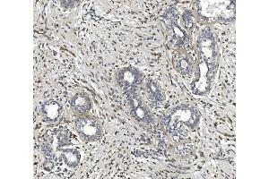 IHC analysis of CTHRC1 using anti-CTHRC1 antibody (ABIN7601256). (CTHRC1 anticorps  (AA 31-243))