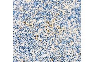 Immunohistochemistry of paraffin embedded mouse spleen using BIRC3 (ABIN7073179) at dilution of 1: 1800 (400x lens)