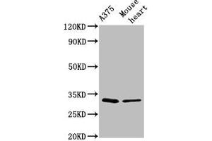 Western Blot Positive WB detected in: A375 whole cell lysate, Mouse heart tissue All lanes: TIMMDC1 antibody at 2. (TIMMDC1 anticorps  (AA 444-585))