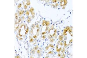 Immunohistochemistry of paraffin-embedded human stomach using TDGF1 antibody (ABIN3021341, ABIN3021342, ABIN3021343 and ABIN6214922) at dilution of 1:100 (40x lens).