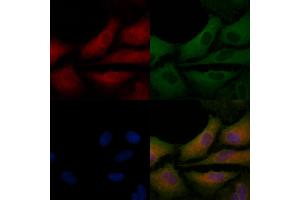 ABIN6258287 and ABIN6275230 staining  cells by IF/ICC.