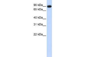 WB Suggested Anti-POSTN Antibody  Titration: 1 ug/ml Positive Control: 293T cells lysate (Periostin anticorps  (Middle Region))