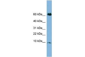 WB Suggested Anti-CRIP1  Antibody Titration: 0. (CRIP1 anticorps  (N-Term))