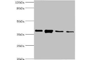 Western blot All lanes: Anxa1 antibody at 2 μg/mL Lane 1: PC-3 whole cell lysate Lane 2: A431 whole cell lysate Lane 3: K562 whole cell lysate Lane 4: MCF-7 whole cell lysate Secondary Goat polyclonal to rabbit IgG at 1/10000 dilution Predicted band size: 39 kDa Observed band size: 39 kDa