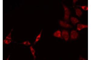 ABIN6275236 staining HeLa by IF/ICC.