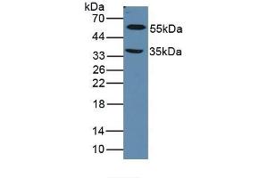 Figure. (LOXL1 anticorps  (AA 392-598))