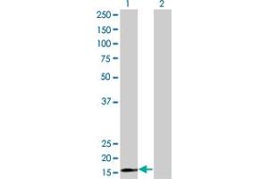 Western Blot analysis of RPS15 expression in transfected 293T cell line by RPS15 monoclonal antibody (M01), clone 4H8. (RPS15 anticorps  (AA 77-145))