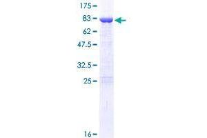 Image no. 1 for DEAD (Asp-Glu-Ala-As) Box Polypeptide 19A (DDX19A) (AA 1-478) protein (GST tag) (ABIN1351322)