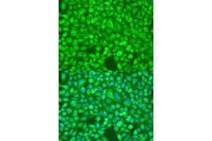 Immunofluorescence analysis of U2OS cells using NFKB2 antibody.