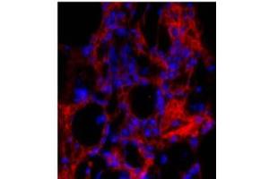 Anti-Collagen 1, alpha 1 telopeptide Antibody - Immunohistochemistry.