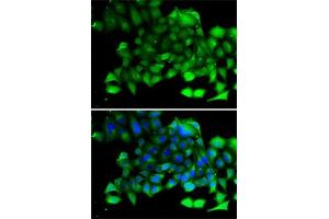 Immunofluorescence analysis of A-549 cells using CLIC4 antibody (ABIN6127638, ABIN6138723, ABIN6138724 and ABIN6222890). (CLIC4 anticorps  (AA 1-253))