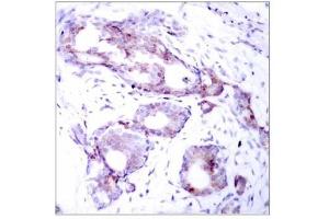 Image no. 1 for anti-Myc Proto-Oncogene protein (MYC) (pSer373) antibody (ABIN196676) (c-MYC anticorps  (pSer373))