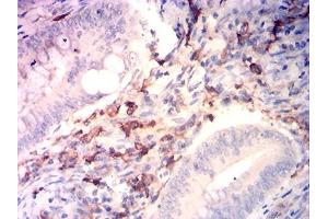 Immunohistochemical analysis of paraffin-embedded rectum cancer tissues using CD14 mouse mAb with DAB staining. (CD14 anticorps  (AA 230-345))