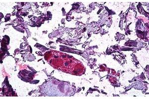 Human Colon, Ganglion: Formalin-Fixed, Paraffin-Embedded (FFPE) (DGAT1 anticorps  (AA 217-229))