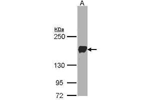 WB Image Sample(30 ug whole cell lysate) A:A431, 5% SDS PAGE antibody diluted at 1:1000 (Protocadherin 1 anticorps)