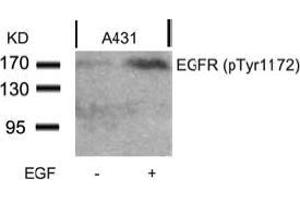 Image no. 2 for anti-Epidermal Growth Factor Receptor (EGFR) (pTyr1172) antibody (ABIN196960) (EGFR anticorps  (pTyr1172))