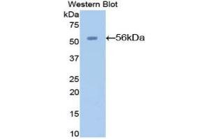 Western Blotting (WB) image for anti-Angiotensinogen (serpin Peptidase Inhibitor, Clade A, Member 8) (AGT) (AA 23-477) antibody (ABIN1173617)