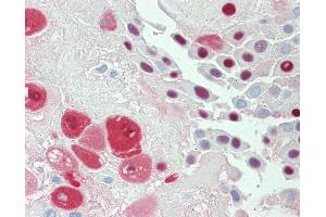 Anti-SERPINB2 / PAI-2 antibody IHC staining of human placenta. (SERPINB2 anticorps)