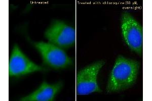 Immunofluorescent analysis of 4 % paraformaldehyde-fixed, 0. (GABARAP anticorps  (AA 1-30))