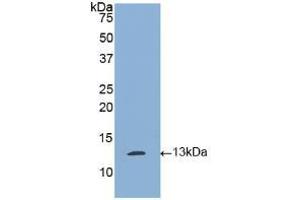 Western blot analysis of recombinant Human tPA. (PLAT anticorps  (AA 36-126))