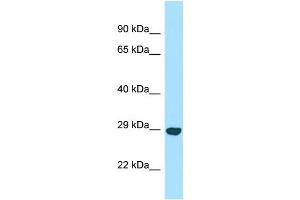 WB Suggested Anti-OFCC1 Antibody Titration: 1. (OFCC1 anticorps  (C-Term))