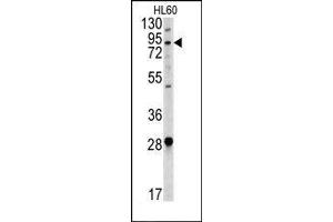Image no. 1 for anti-Angiotensin I Converting Enzyme 2 (ACE2) (Center) antibody (ABIN358576) (ACE2 anticorps  (Center))