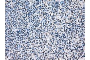 Image no. 5 for anti-Protein Phosphatase 5, Catalytic Subunit (PPP5C) antibody (ABIN1500389)