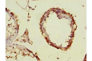 Immunohistochemistry of paraffin-embedded human testis tissue using ABIN7151794 at dilution of 1:100 (ENKD1 anticorps  (AA 1-346))