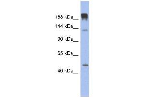SLIT3 antibody used at 1 ug/ml to detect target protein. (SLIT3 anticorps)