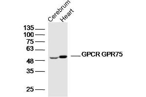 Lane 1: Mouse cerebrum lysates Lane 2: mouse heart lysates probed with GPCR GPR75 Polyclonal Antibody, Unconjugated  at 1:300 dilution and 4˚C overnight incubation. (GPR75 anticorps  (AA 151-250))