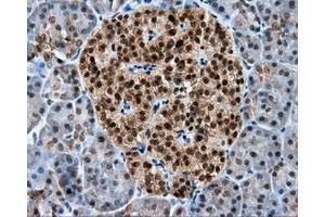 Immunohistochemical staining of paraffin-embedded liver tissue using anti-RALBP1 mouse monoclonal antibody. (RALBP1 anticorps)